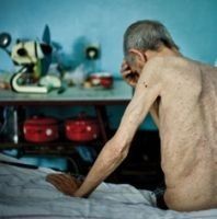 "Остановим туберкулез в Украине" Фотовыставка Максима Дондюка "Остановим туберкулез в Украине" Фотовыставка Максима Дондюка