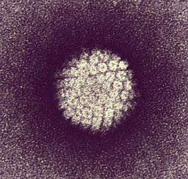 Признаки заболевания вирусом папилломы человека