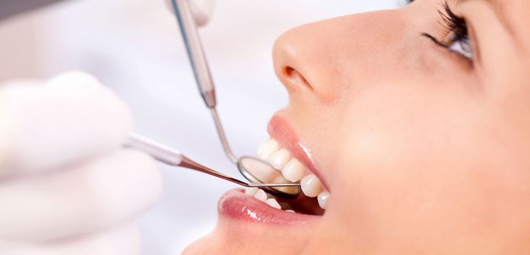 Ортодонтическое лечение поможет создать идеальную улыбку